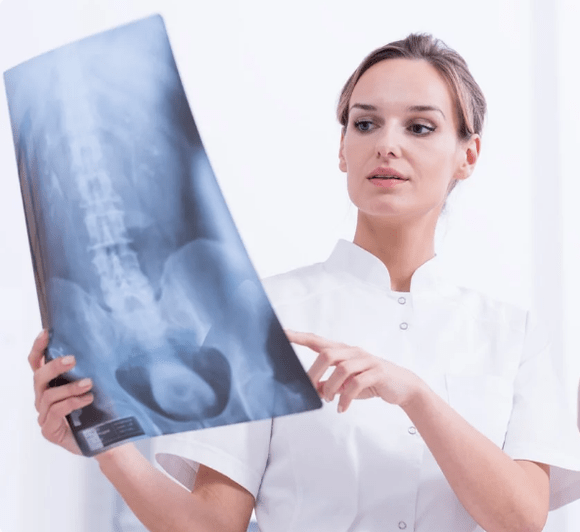 Diagnóstico de una osteocondrosis torácica
