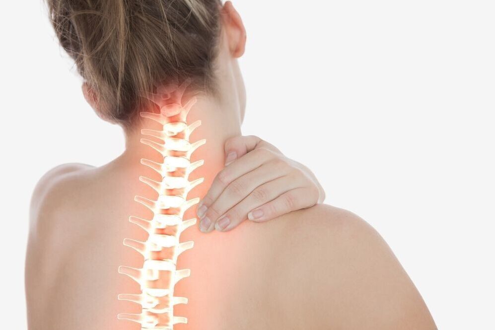 Dolor de cuello con osteocondrosis cervical de la columna.