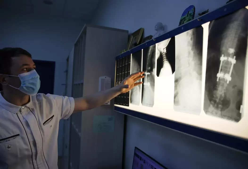 Los médicos diagnostican la osteocondrosis cervical mediante métodos instrumentales como la radiografía. 